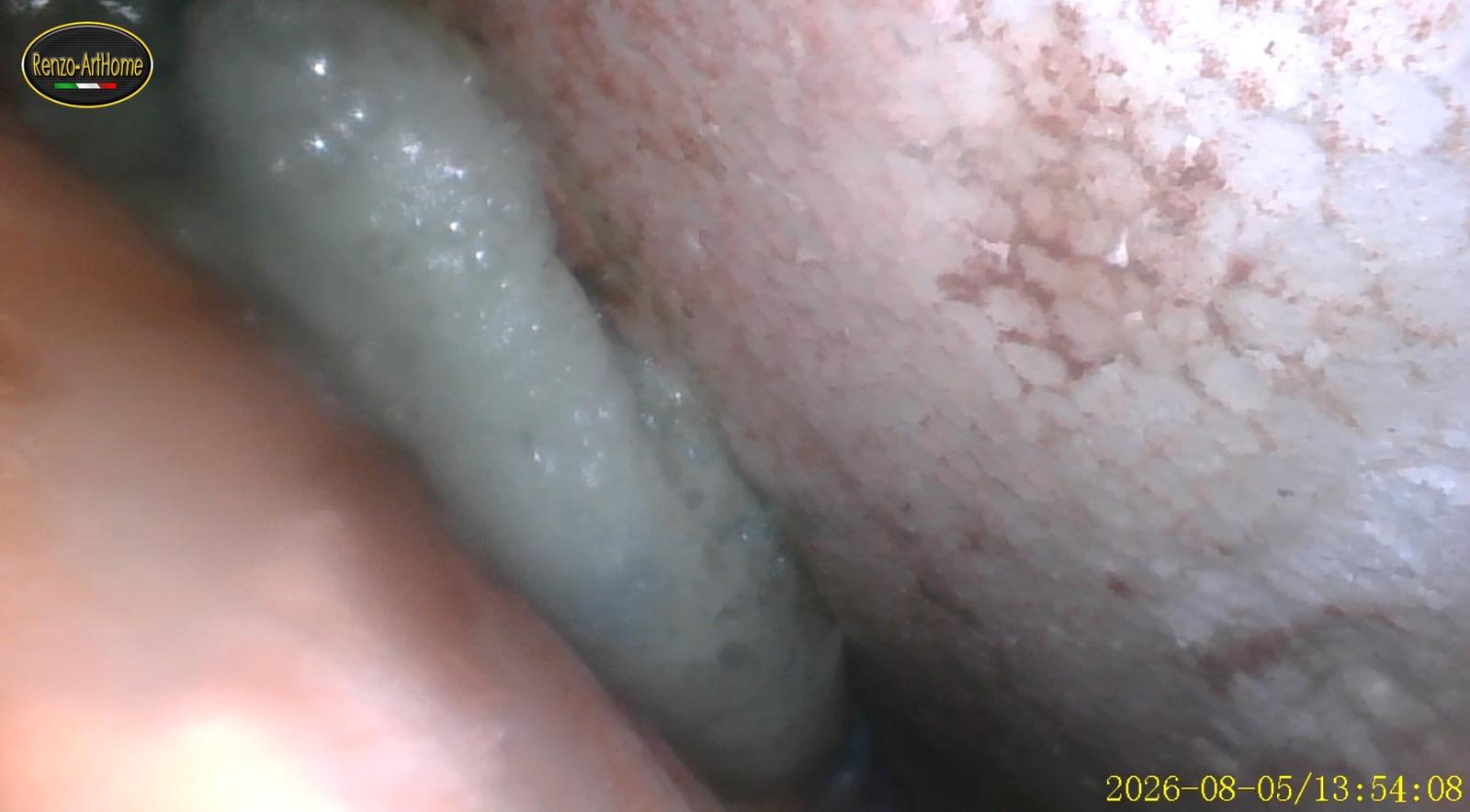 La resina espansa riempie il campo visivo dell'endoscopio
